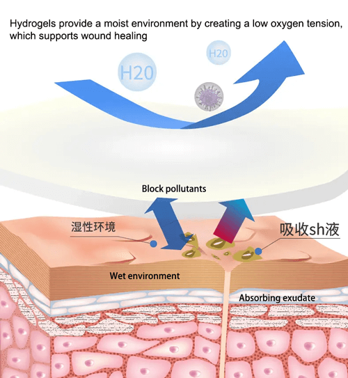Hydrocolloid blister plaster helps heal and prevent blisters. Provide instant relief from painful blisters. Keep the wound from dirt,germs and bacteria.