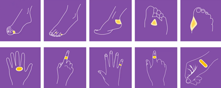 Hydrocolloid blister plaster helps heal and prevent blisters. Provide instant relief from painful blisters. Keep the wound from dirt,germs and bacteria.
